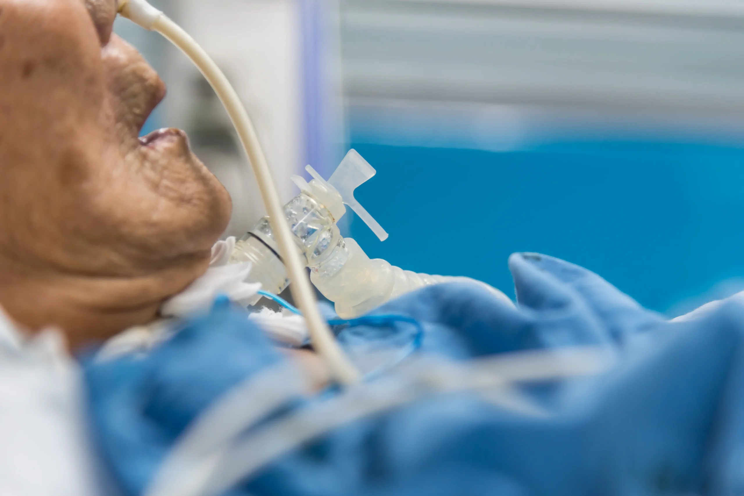 Patient mit Tracheostomie und Beatmung – spezialisierte 1-1 Intensivpflege zu Hause durch VPS Intensivpflegedienst GmbH